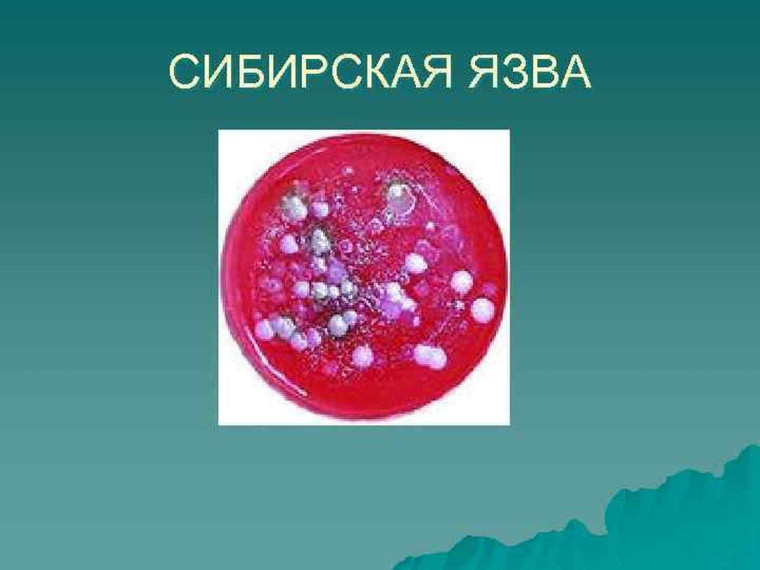 Памятка владельцам животных «Сибирская язва». Памятка владельцам животных «Сибирская язва».